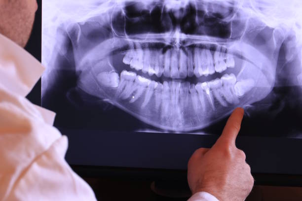 Best Emergency Dental Services for Seniors in Greenacres, FL